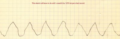 Kilkeel sound carrier signal strength chart pen chart recording